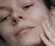 frau trockene haut hand